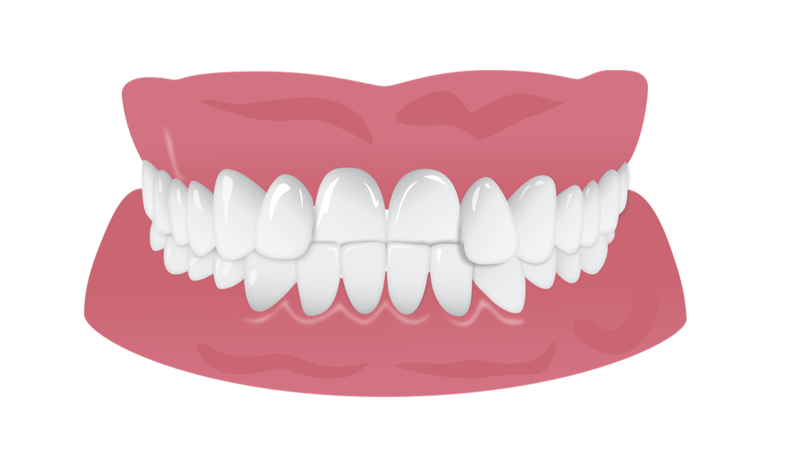 Healthy Tooth Free Transparent Image HD PNG Image