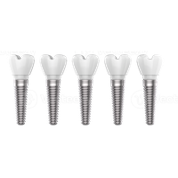 Dental Implant PNG Category