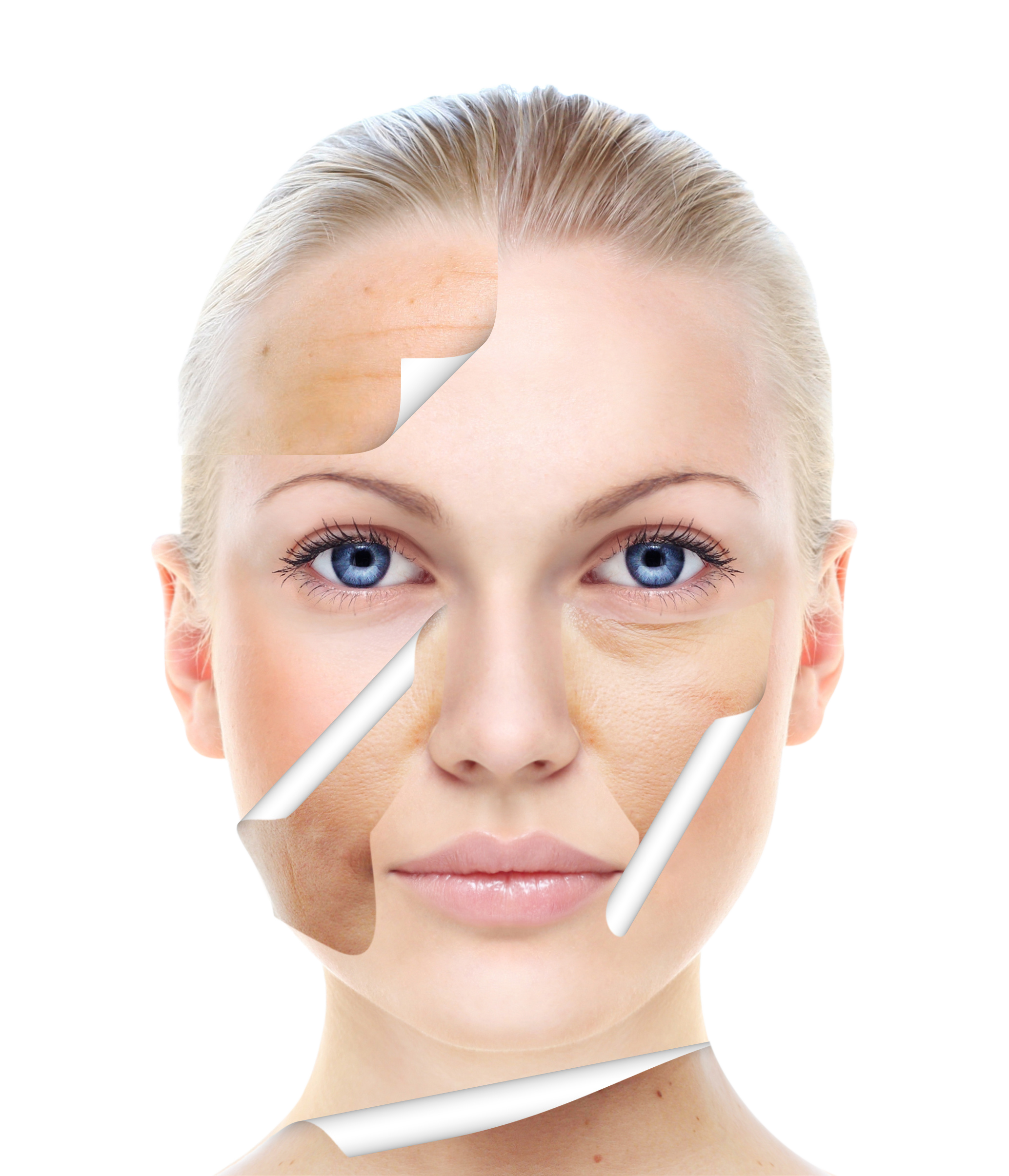 Icon skin peeling. Пилинг. Омоложение кожи лица. Лицо до после клипарт. Кожа морщины клипарт.