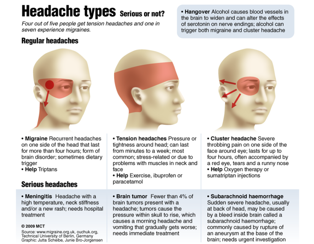 Ache Head Face Eyewear Headache Download HD PNG PNG Image