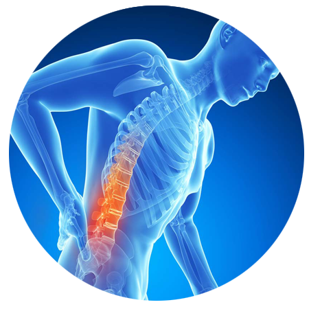 Download Back Pain Picture Free Photo PNG HQ PNG Image | FreePNGImg