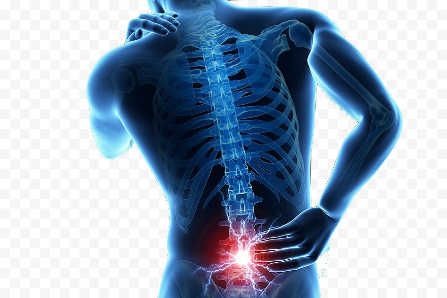 Back Pain HQ Image Free PNG PNG Image