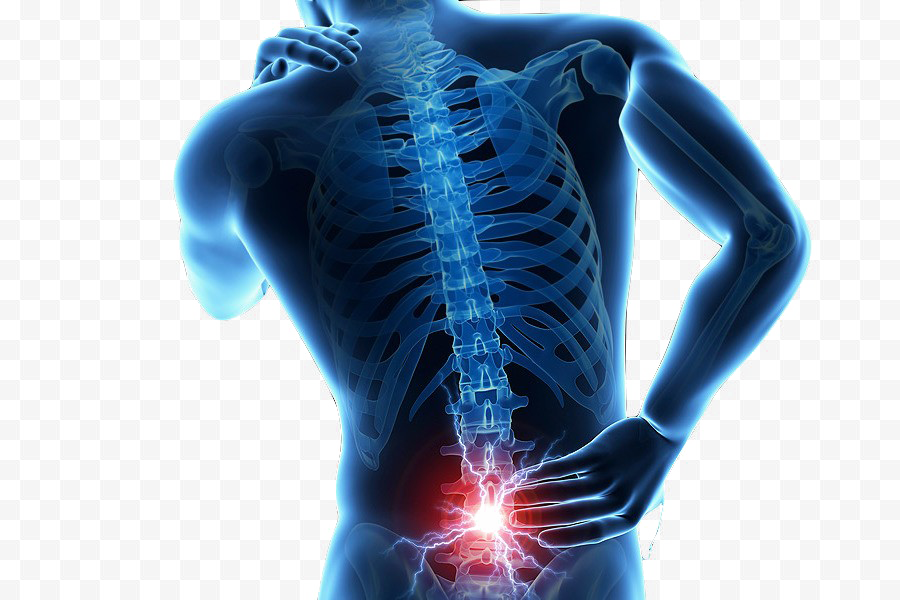 Back Pain HQ Image Free PNG Transparent PNG Image