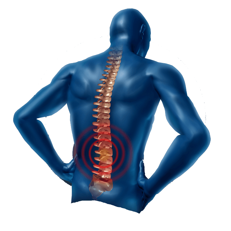 Pain In The Neck Image PNG Image