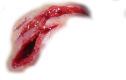 Scar Transparent PNG Image