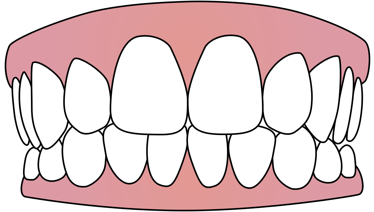Clean Tooth Free Download PNG HD PNG Image