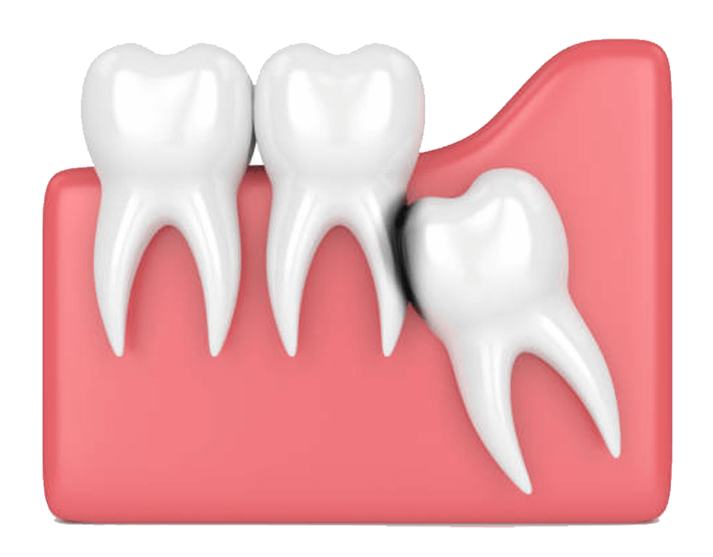 Crying Tooth Free HQ Image PNG Image