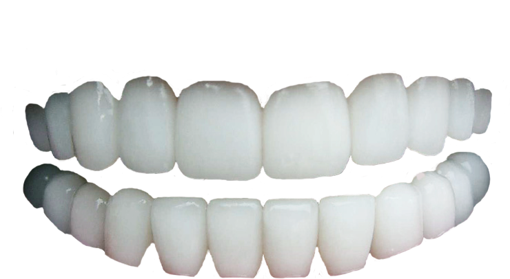 White Tooth Free Clipart HD PNG Image