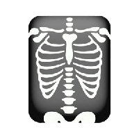 X-rays PNG