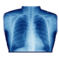 X-rays PNG