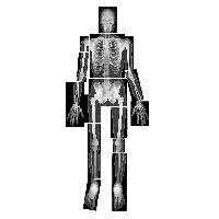X-rays PNG