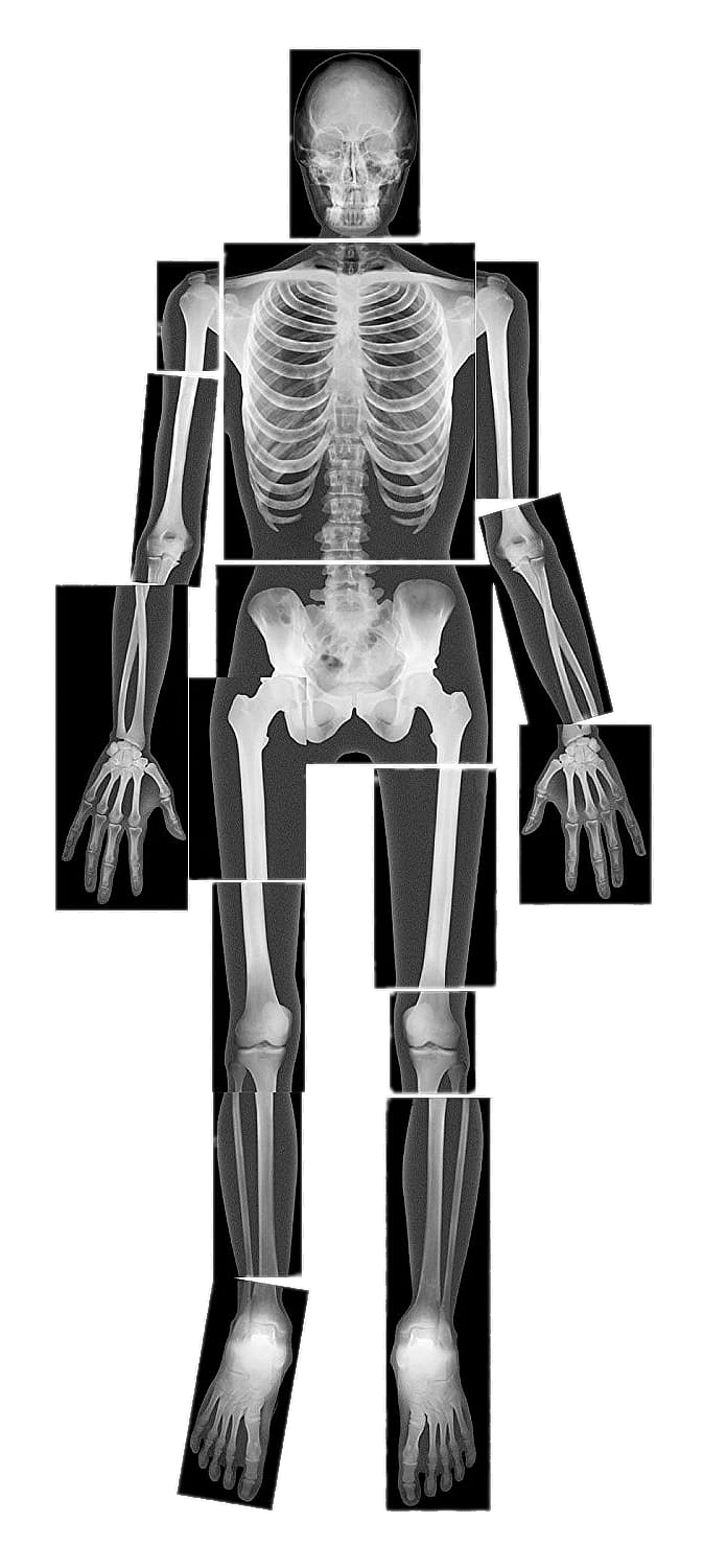 X-rays Transparent PNG Image