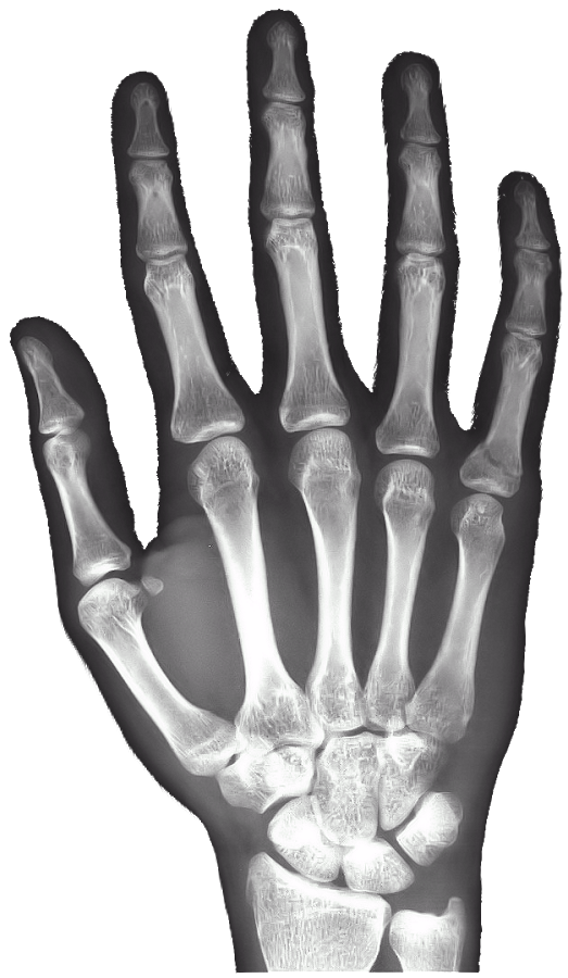 X-rays Transparent PNG Image